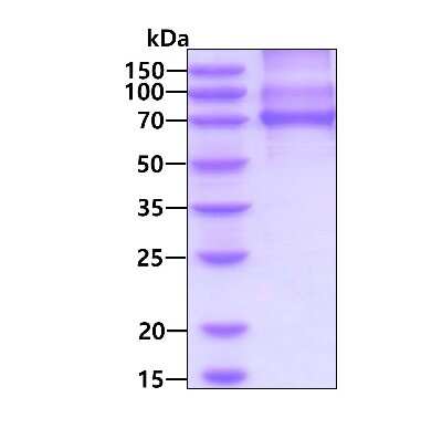 SDS-PAGE: Recombinant Human PKC iota His Protein [NBP3-18181]